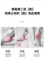 سوهان پا Hipo